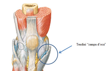 Tendinopatia della Zampa D’Oca.